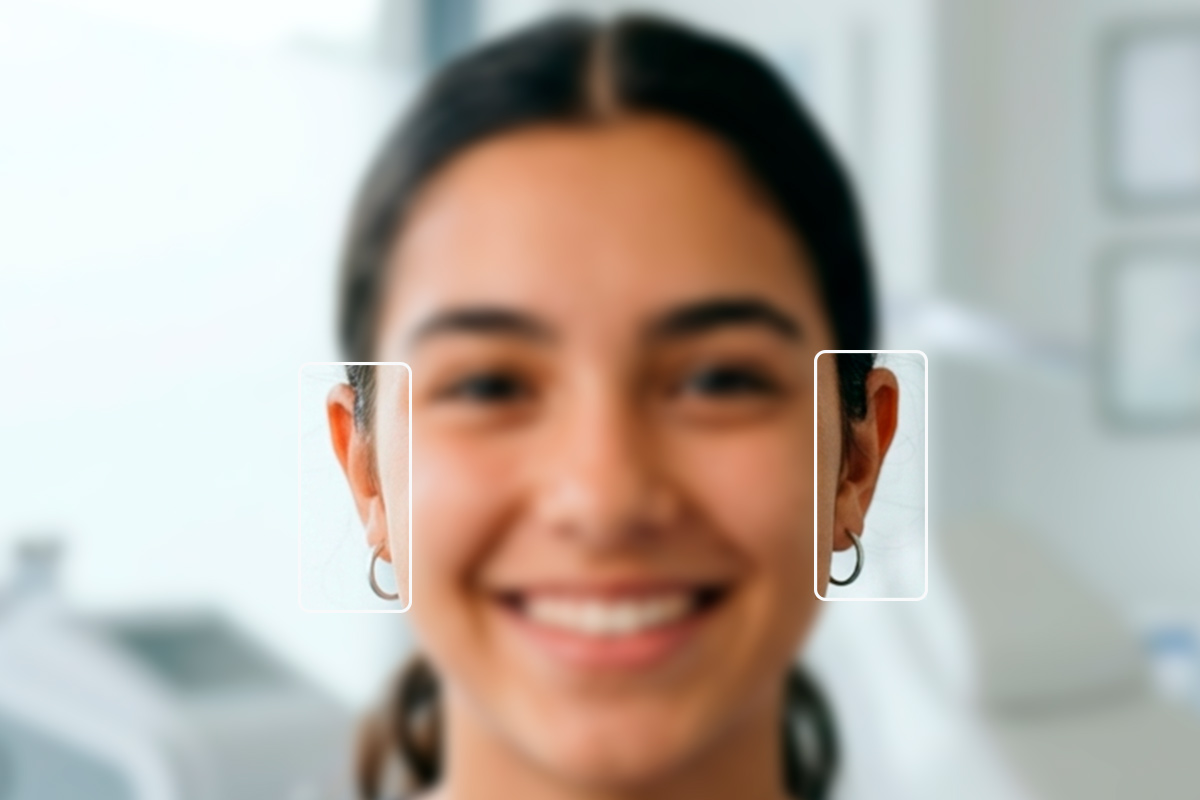 cirugia de orejas, otoplastia quito