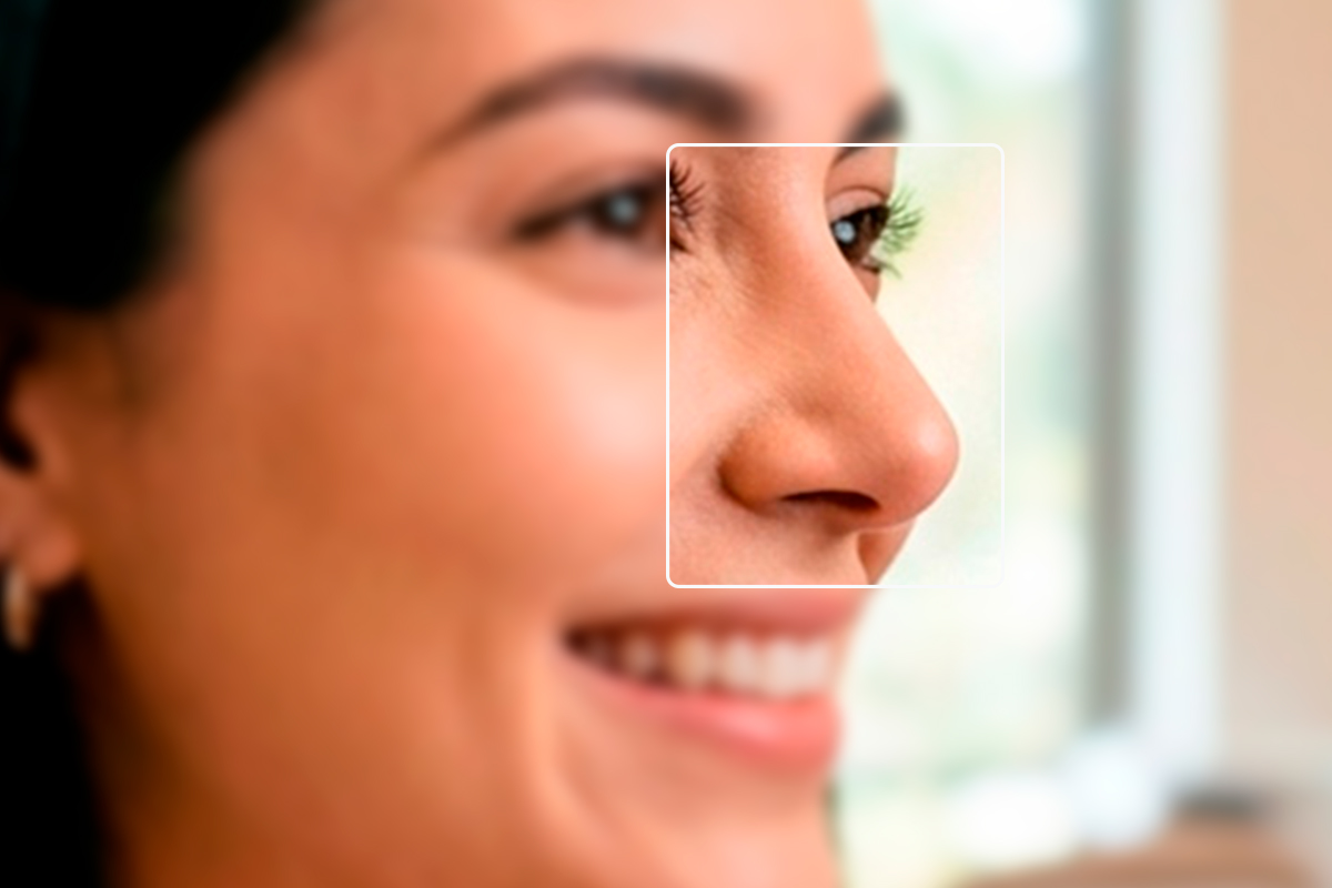 rinoplastia cirugia nariz quito
